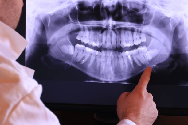 Best Emergency Tooth Extraction in Gotha, FL